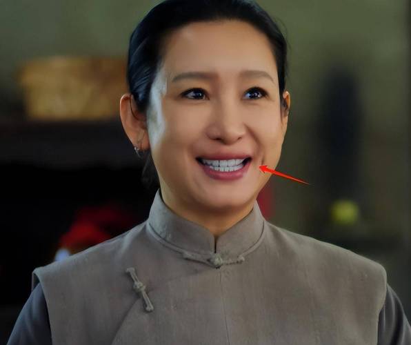 烤瓷牙的女明星_女明星烤瓷牙_明星烤瓷牙翻车